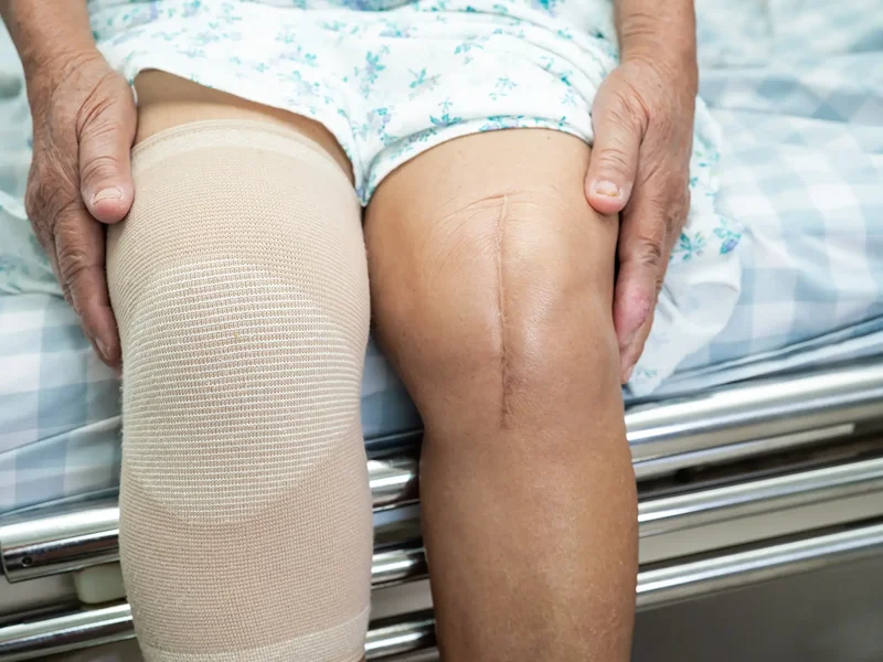 Physical therapist assessing a patient's knee motion before or after knee replacement