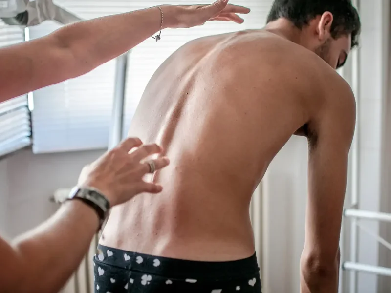 Physical therapist evaluating a patient's spinal curve and posture for scoliosis